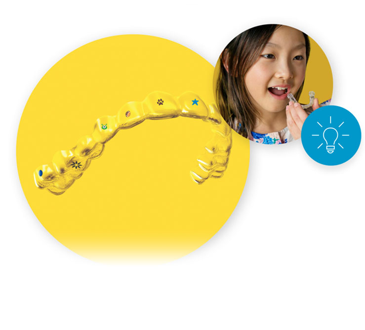 invisalign_first_01
